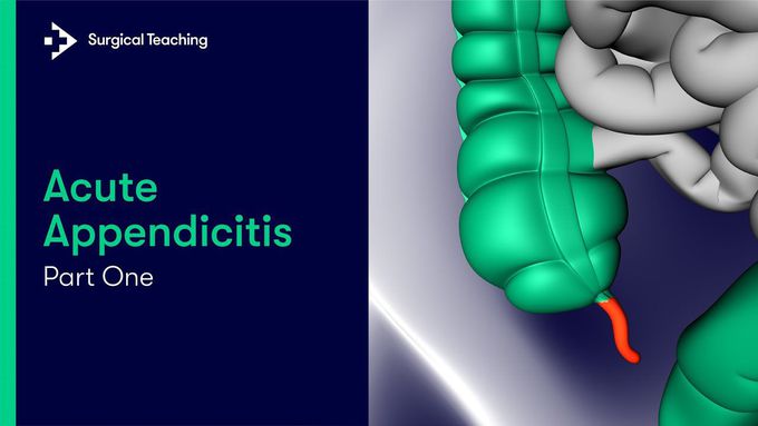 Acute Appendicitis Part 1