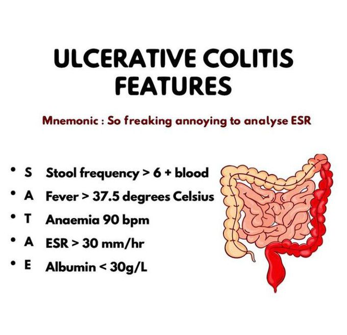 Ulcerative Colitis Medizzy 9314