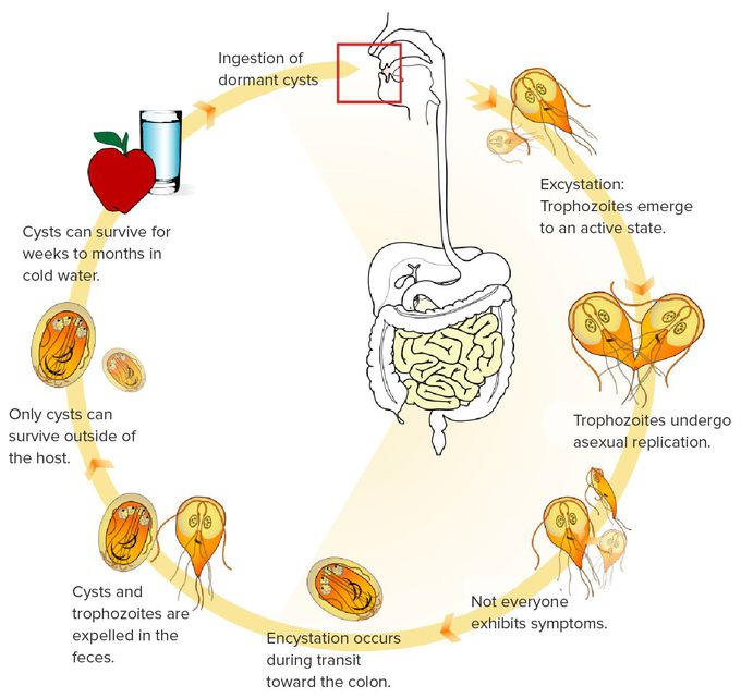 Giardiasis