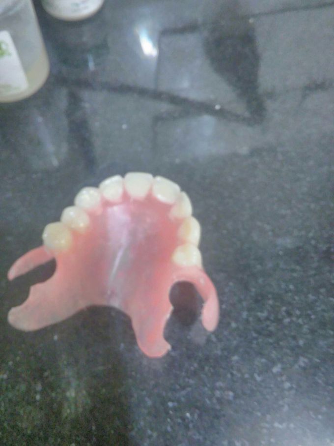 Flexible denture
