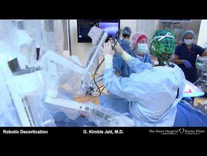 Robotic-Assisted Total Decortication of Right Lung for Fibrothorax