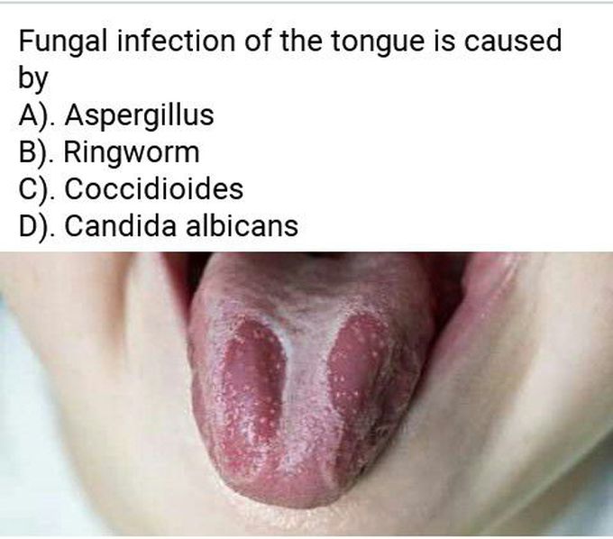 Fungi disease