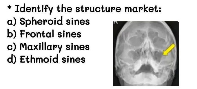 Identify the Structure