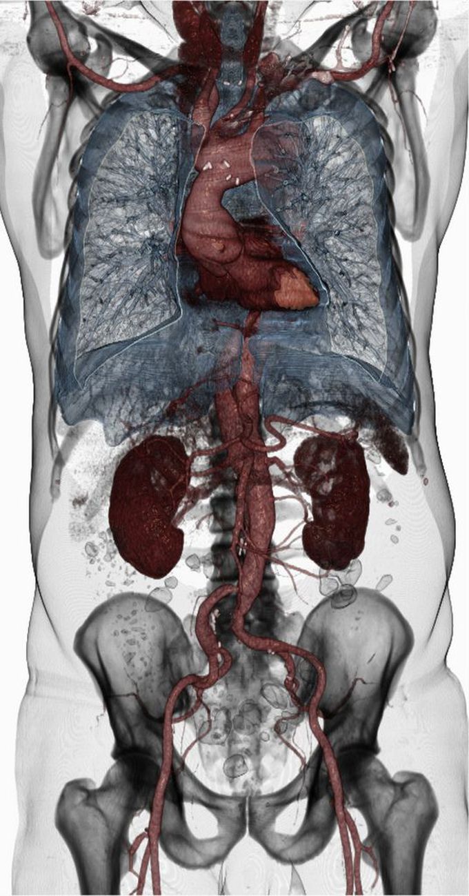 radiology