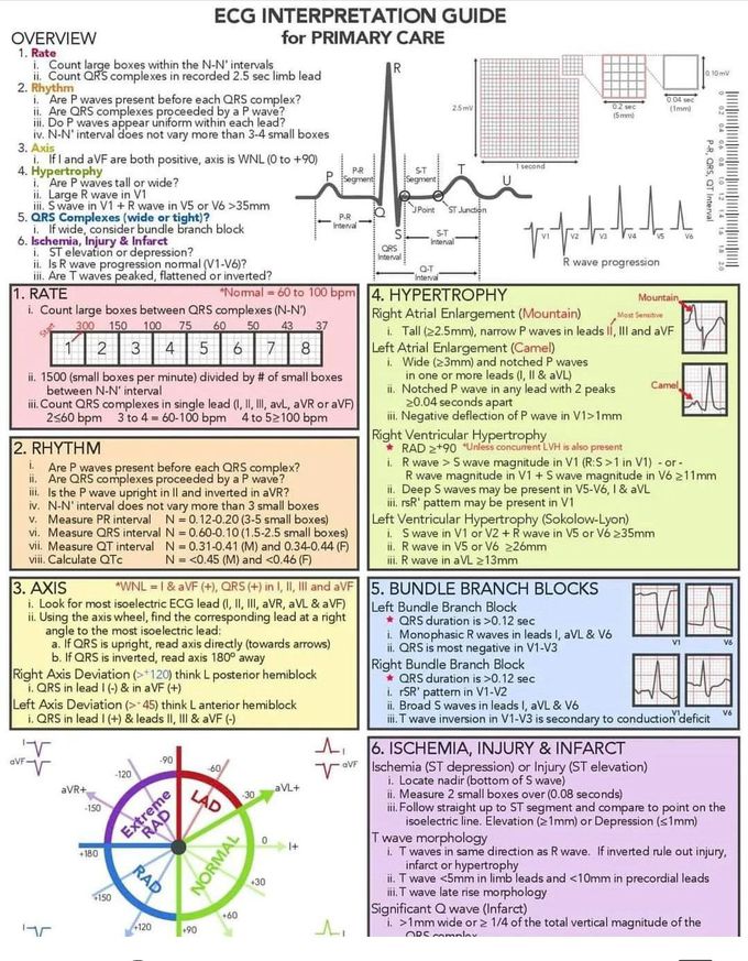 ECG Interpretation