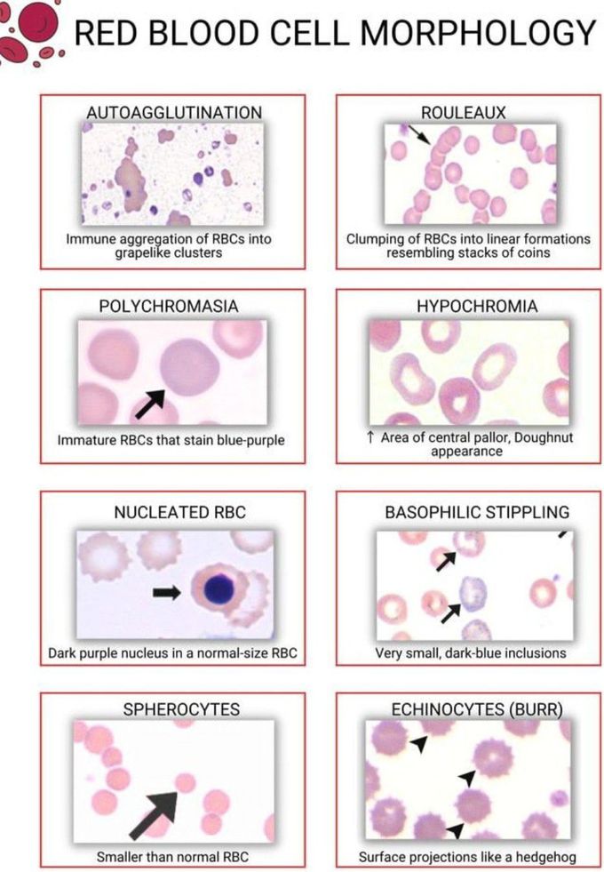 RBC Morphology