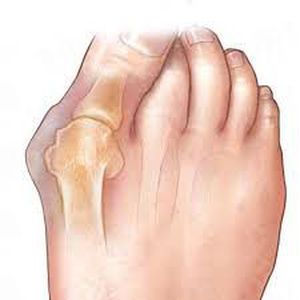 Do you know the name and cause of this condition? - MEDizzy
