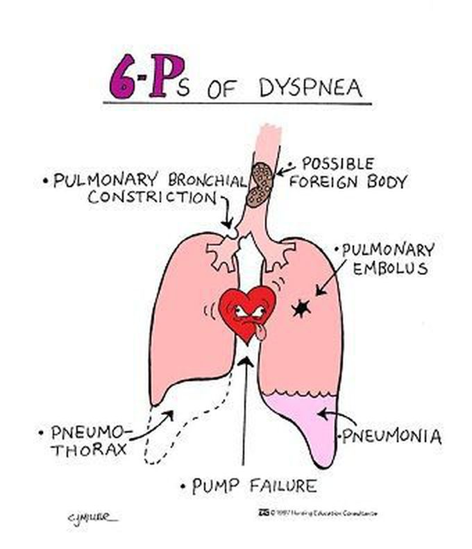 Mnemonics For Nursing - Different Nursing Assessment