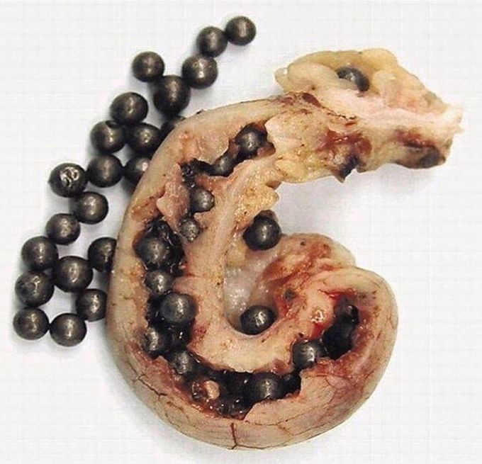 Pellets in the appendix !