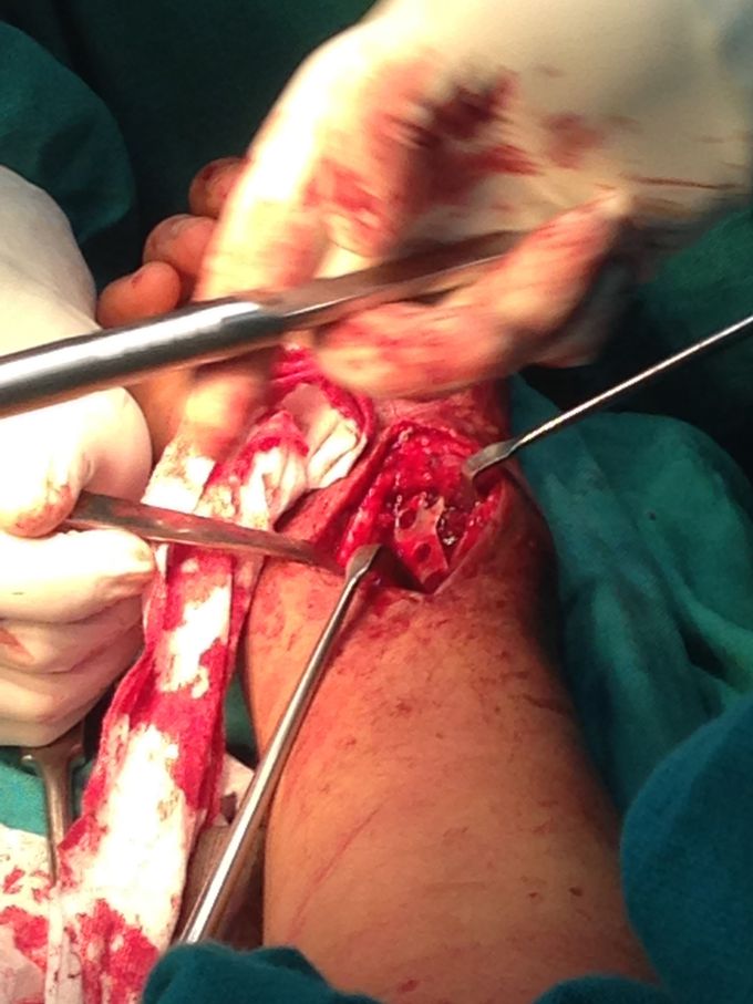 Orthopaedic surgery