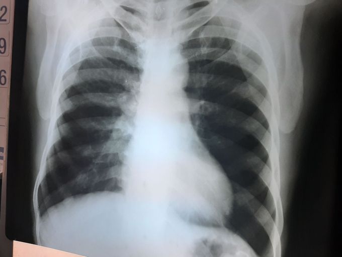 Diagnosis