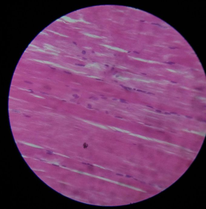 Identify the type of muscles