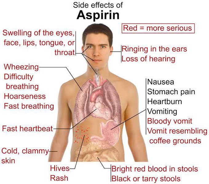 Sideeffects of aspirin