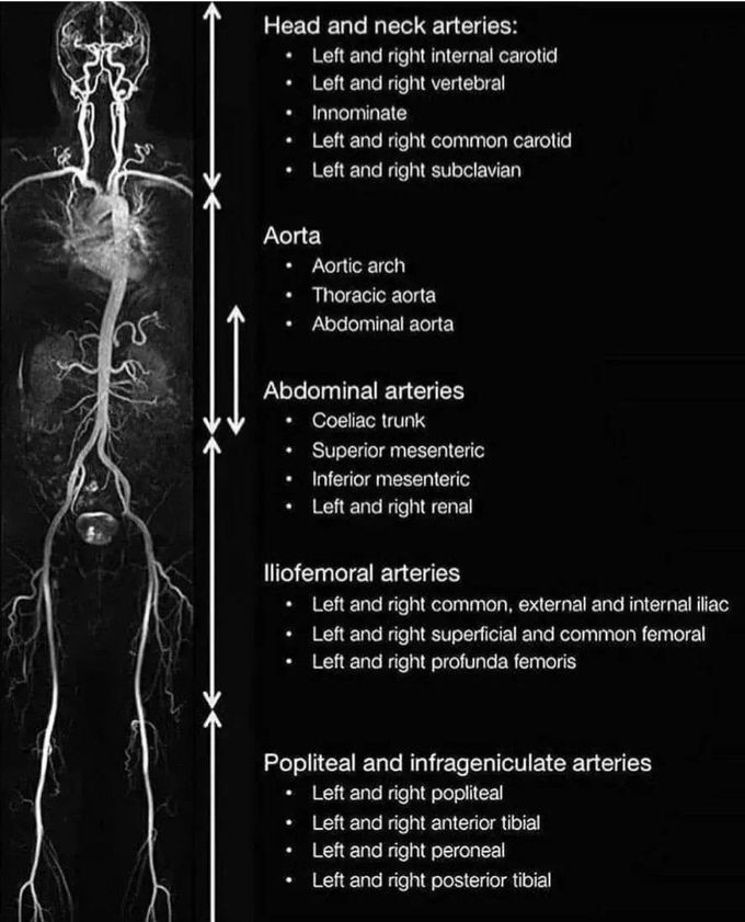 MRA of the Body
