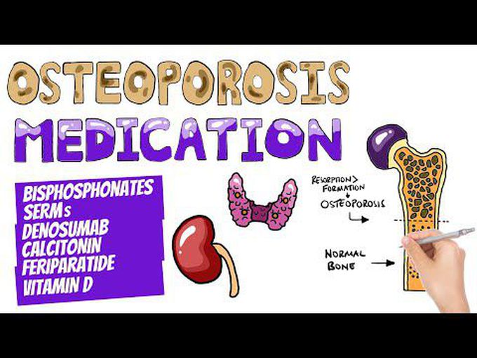 Osteoporosis Drugs
