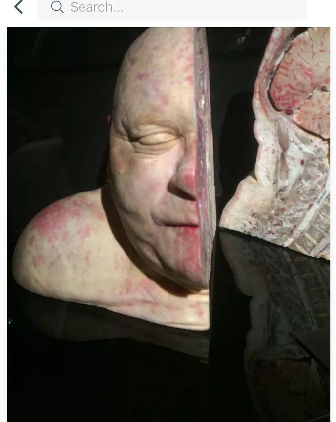 Wow how scary this is half of the head