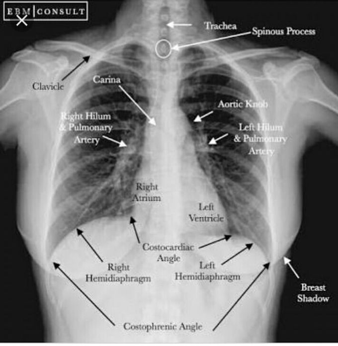 X-RAY - MEDizzy