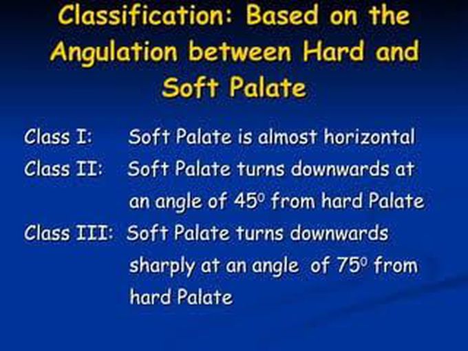 House' classification for Soft palate