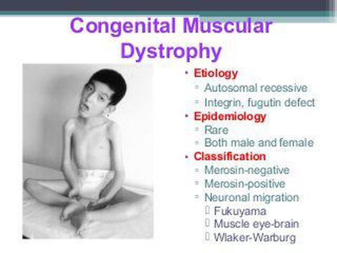 Congenital muscular dystrophy (CMD)