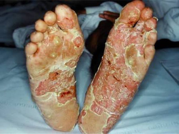 Diagnosis??