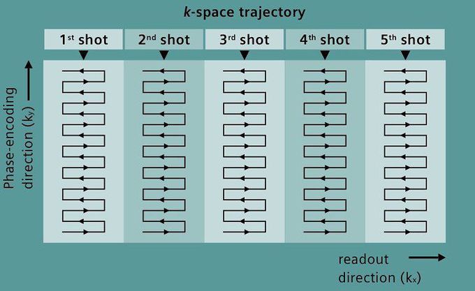 DWI with readout-segmented EPI