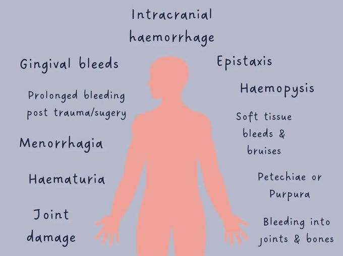 Hemophilia- Symptoms
