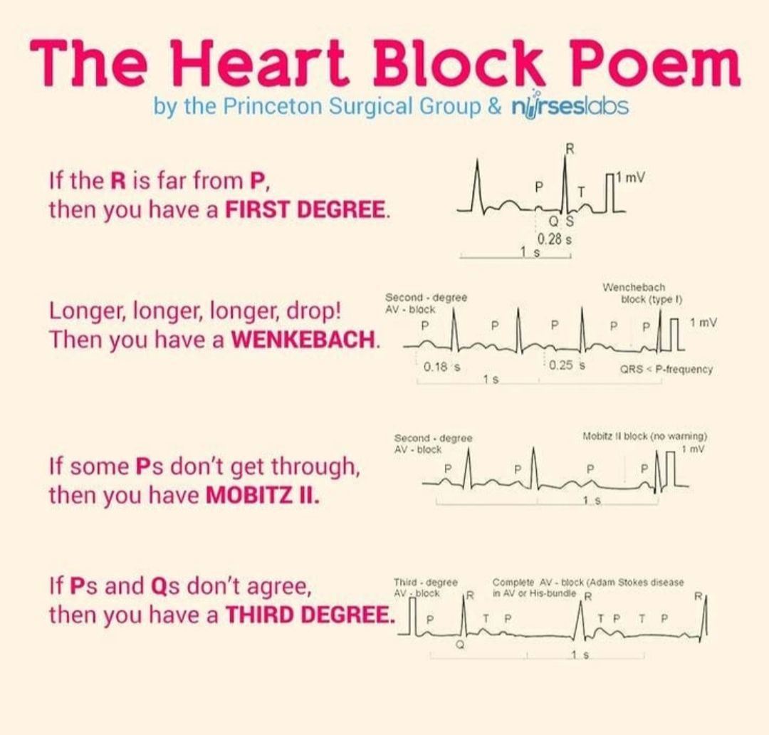 HEART BLOCK POEMEASY WAY TO REMEMBER MEDizzy