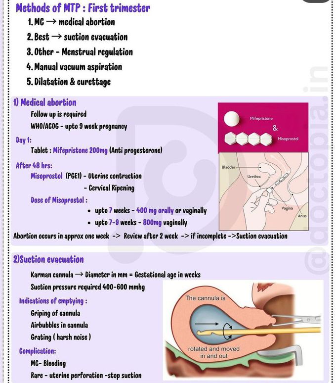 Medical Termination of Pregnancy (MTP) II