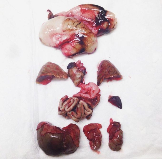 Collection of fetal organs