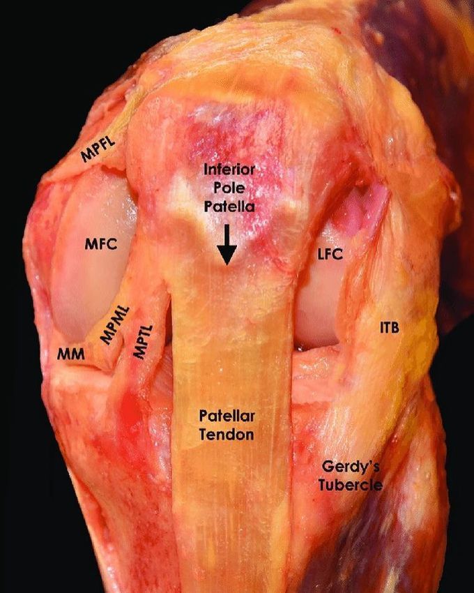 Anterior view of the left knee