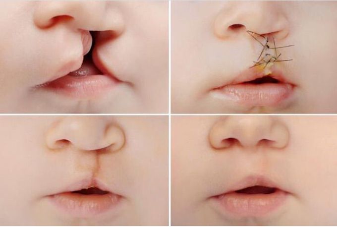 What is the name of this condition?