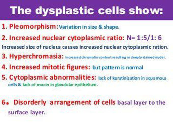 Causes of dysplasia