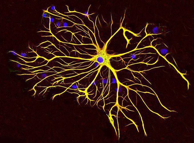 Newly Named ieAstrocytes Viewed as a Key Gatekeeper and Mediator of Disease