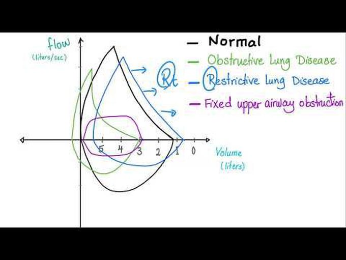 Flow Volume Loops | Pulmonary Medicine