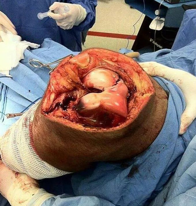 orthopedic surgery