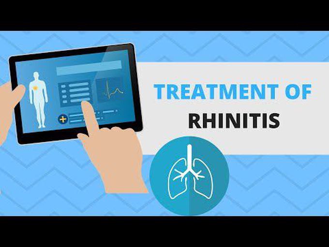 How can rhinitis be treated?