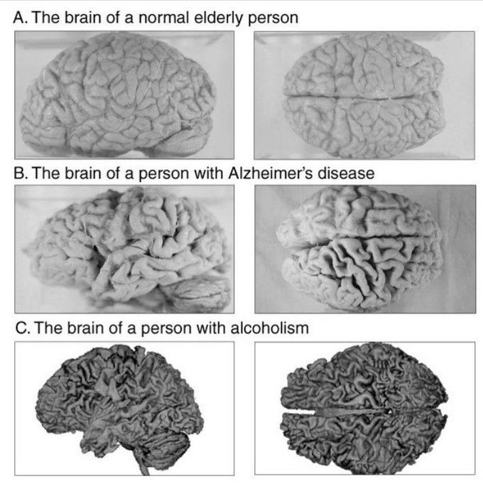 How alcohol affects brain?