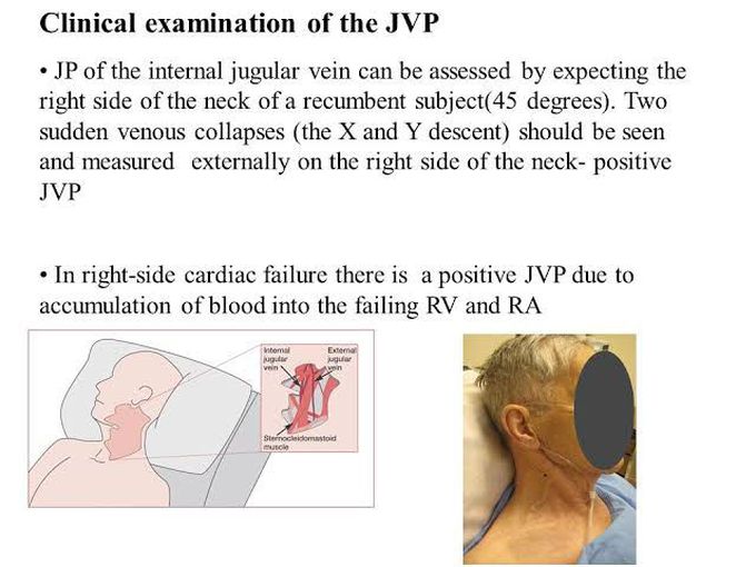 JVP- Clinical Examination