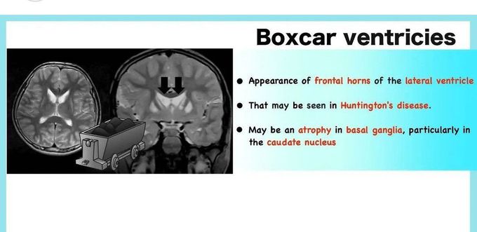 Boxcar Ventricles - MEDizzy