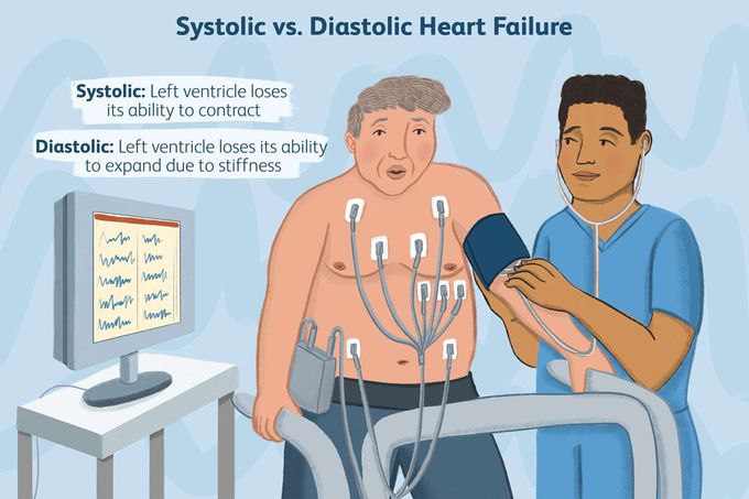 Systolic heart failure