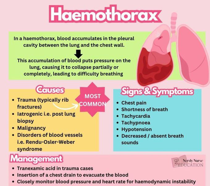 Hemothorax