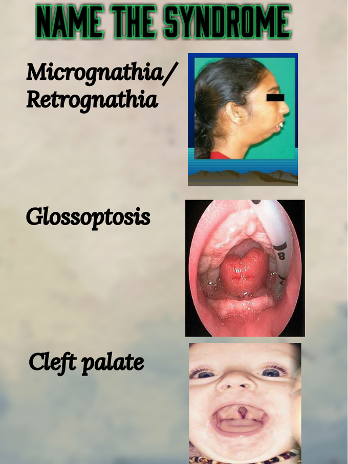 Name the SYNDROME