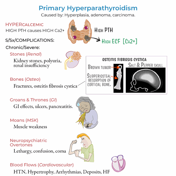 Primary Hyperparathyroidism