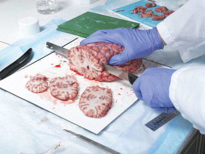 Brain dissection