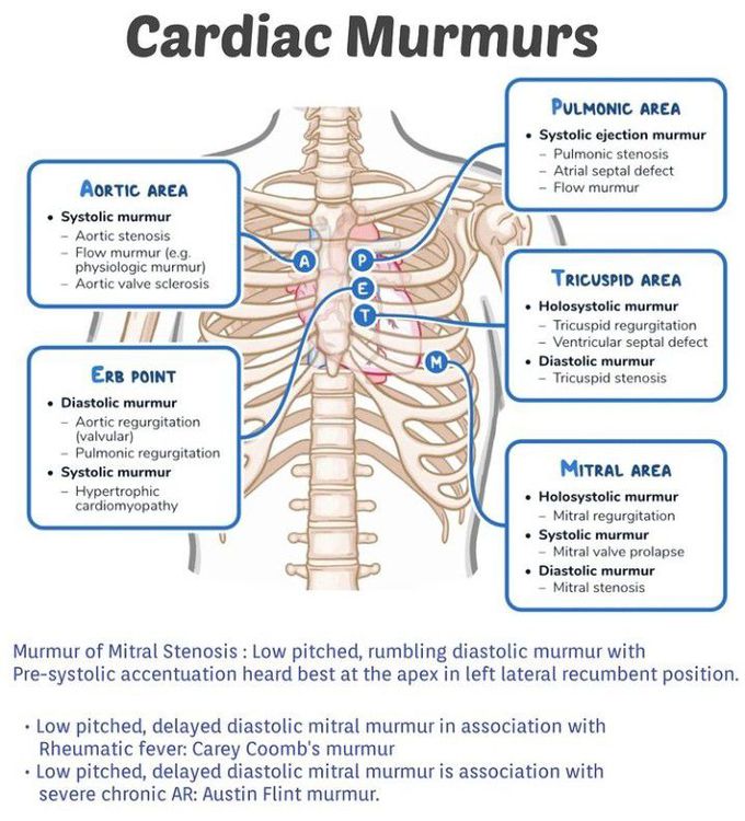 Cardiac murmurs