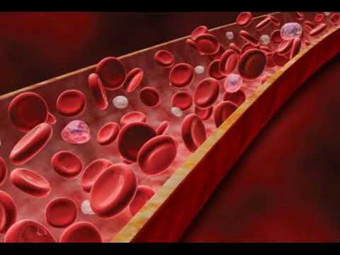 Forms and causes of Agranulocytosis