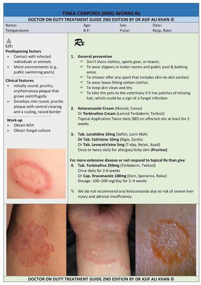 Tinea Corporis (Ring Worm) Management