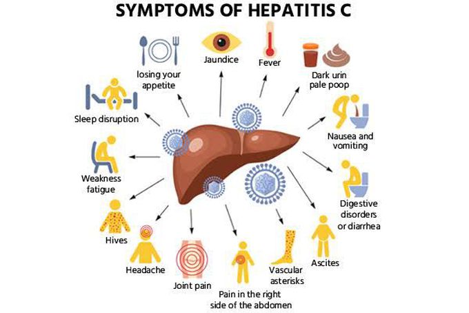 Hepatitis C Symptoms