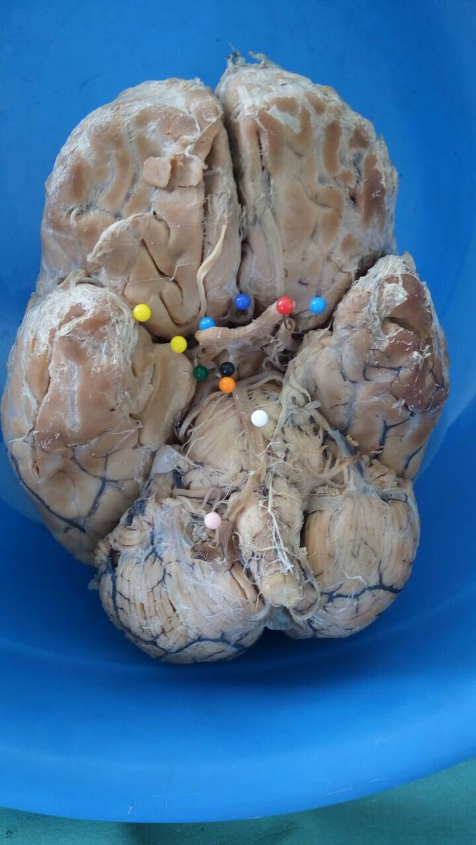 “BLOOD SUPPLY OF BRAIN”
