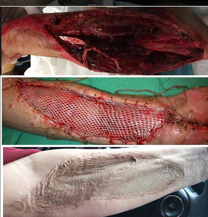 Before and after surgery